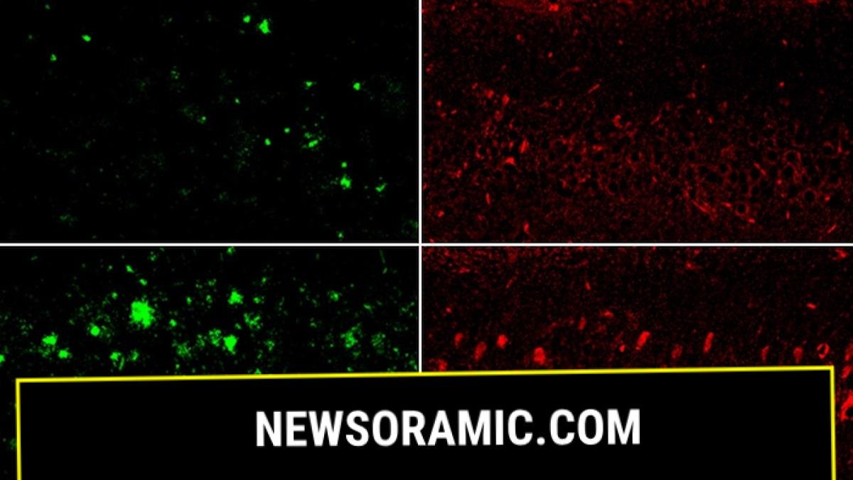 Mouse model of Alzheimer's disease