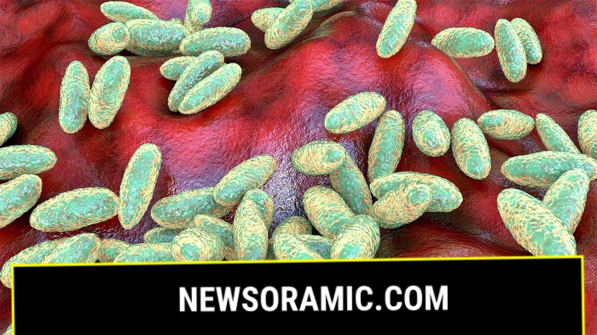 Plague bacteria (Yersinia pestis) cause bubonic plague and are carried in the pathogen of rats and there are still many regions where the disease occurs.