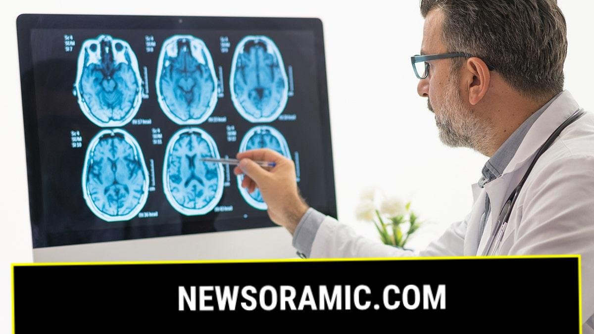 doctor examines brain scans