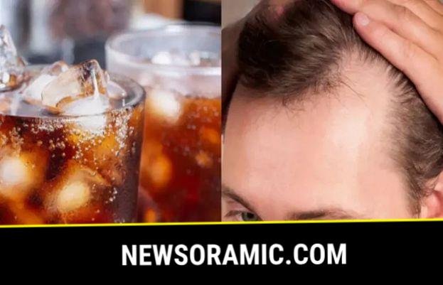 Too many sugary drinks may trigger hair loss, study finds - SUCH TV