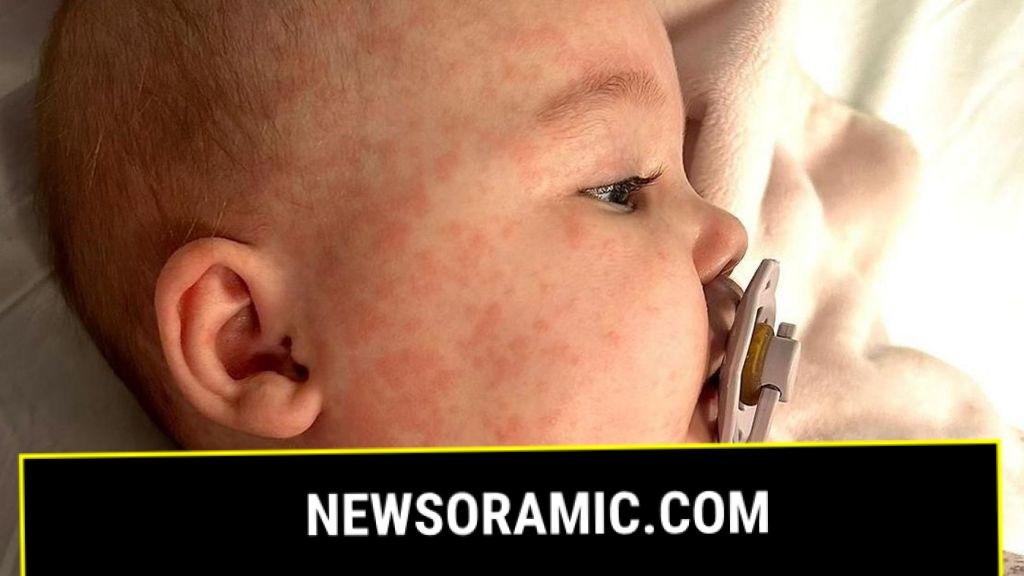County Durham mother's vaccination plea after 'terrifying' measles