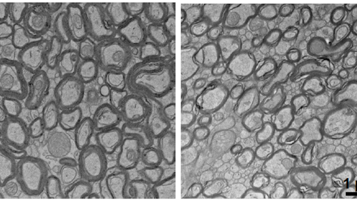 Mouse brain cells Alzheimer's study