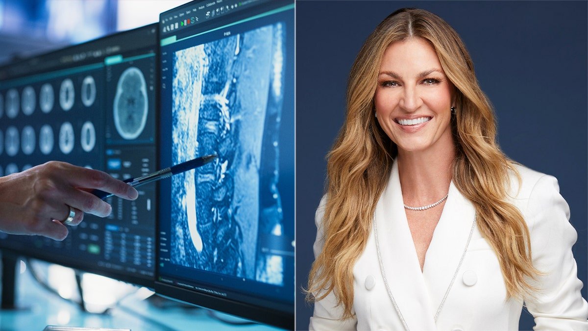 split image of Erin Andrews next to a brain scan