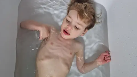 Elissa Novak Ivan lying down in a bath of water showing signs of being underweight. He is a young boy with blonde hair.