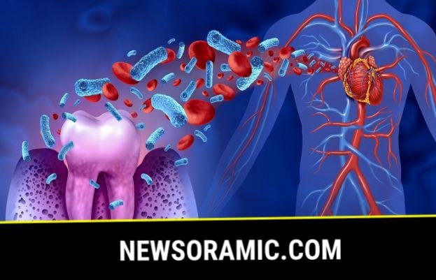 Oral bacteria may increase heart diseases risk - SUCH TV