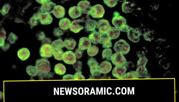 A photomicrograph provided by the CDC depicts a case of primary amebic meningoencephalitis, a rare brain infection due to Naegleria fowleri, a brain-eating amoeba. — Reuters