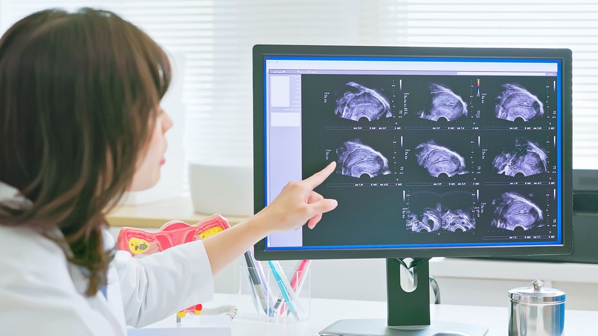 OBGYN review ultrasound on computer